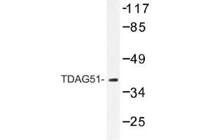 Image no. 1 for anti-Pleckstrin Homology-Like Domain, Family A, Member 1 (PHLDA1) antibody (ABIN317621) (PHLDA1 Antikörper)