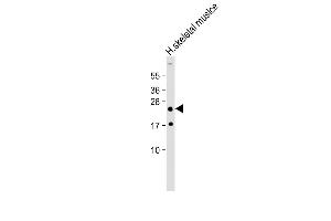Anti-HOXA7 Antibody (Center) at 1:2000 dilution + Human skeletal muslce lysate Lysates/proteins at 20 μg per lane. (HOXA7 Antikörper  (AA 82-114))