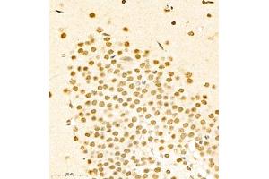 Immunohistochemistry (Paraffin-embedded Sections) (IHC (p)) image for anti-RNA Binding Motif Protein 45 (RBM45) antibody (ABIN7075477)