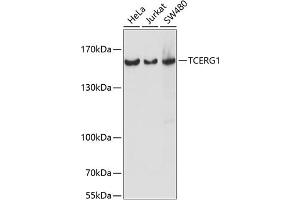 Western blot analysis of extracts of various cell lines, using TCERG1 antibody (ABIN7270879) at 1:1000 dilution. (TCERG1 Antikörper  (AA 550-650))