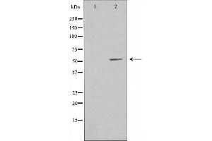 Western blot analysis of extracts from HuvEc cells using PPP2R5A antibody. (PPP2R5A Antikörper  (Internal Region))