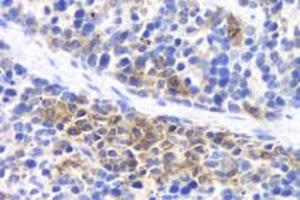 Immunohistochemistry analysis of paraffin-embedded mouse inflammatory spleen using IL-17 (ABIN7074342) at dilution of 1:800 (IL-17 Antikörper)