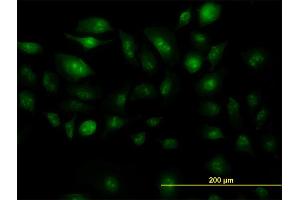 Immunofluorescence of monoclonal antibody to ZIC4 on HeLa cell. (ZIC4 Antikörper  (AA 249-319))