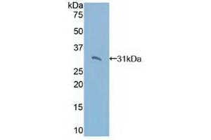 Detection of Recombinant TRADD, Human using Polyclonal Antibody to TNFRSF1A Associated Via Death Domain Protein (TRADD) (TRADD Antikörper  (AA 61-297))