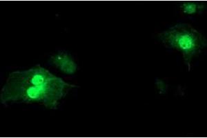 Anti-SDS mouse monoclonal antibody (ABIN2455363) immunofluorescent staining of COS7 cells transiently transfected by pCMV6-ENTRY SDS (RC217814). (serine Dehydratase Antikörper)