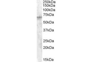 Image no. 1 for anti-Insulin-Like Growth Factor 2 mRNA Binding Protein 2 (IGF2BP2) (C-Term) antibody (ABIN374940) (IGF2BP2 Antikörper  (C-Term))