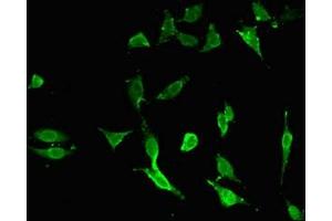 Immunofluorescent analysis of Hela cells using ABIN7173772 at dilution of 1:100 and Alexa Fluor 488-congugated AffiniPure Goat Anti-Rabbit IgG(H+L) (TNFAIP3 Antikörper  (AA 97-183))