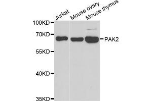 Western blot analysis of extracts of various cell lines, using PAK2 antibody. (PAK2 Antikörper)