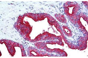 Human Prostate: Formalin-Fixed, Paraffin-Embedded (FFPE) (LAMP2 Antikörper)