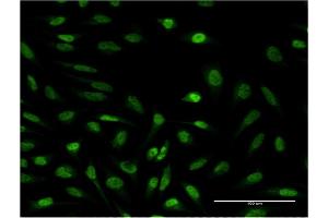Immunofluorescence of monoclonal antibody to SUPT4H1 on HeLa cell. (SUPT4H Antikörper  (AA 18-117))