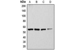 Western blot analysis of ATP6V1H expression in Caki1 (A), SKNSH (B), rat kidney (C), mouse brain (D) whole cell lysates. (ATP6V1H Antikörper  (Center))