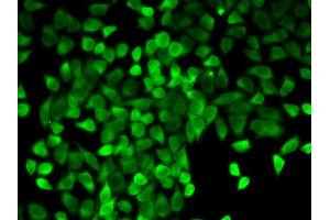 Immunofluorescence analysis of A549 cell using CASP3 antibody. (Caspase 3 Antikörper  (AA 55-160))