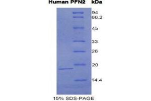 SDS-PAGE (SDS) image for Profilin 2 (PFN2) (AA 5-140) protein (His tag) (ABIN1981176)