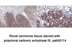 Image no. 1 for anti-Carbonic Anhydrase IX (CA9) (AA 400-500), (C-Term) antibody (ABIN363423) (CA9 Antikörper  (C-Term))