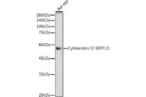 Western blot analysis of extracts of Rat eye, using Cytokeratin 12 (KRT12) (KRT12) antibody (ABIN7268087) at 1:500 dilution. (KRT12 Antikörper)