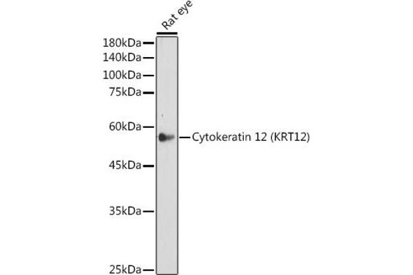 KRT12 Antikörper