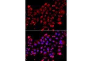 Immunofluorescence analysis of A549 cells using RRM2B antibody (ABIN5974964). (RRM2B Antikörper)