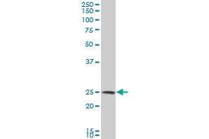 NQO2 polyclonal antibody (A01), Lot # DOH0051214QCS1 Western Blot analysis of NQO2 expression in HeLa .