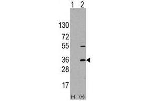 Image no. 1 for anti-Signal Sequence Receptor, alpha (SSR1) (N-Term) antibody (ABIN356936) (SSR1 Antikörper  (N-Term))