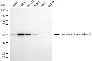 Western blotting analysis using leucine aminopeptidase 3 antibody (ABIN7798268). (Rekombinanter LAP3 Antikörper)