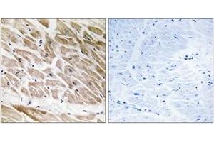 Immunohistochemistry analysis of paraffin-embedded human heart tissue, using RHG1 Antibody. (RHG1 (AA 189-238) Antikörper)