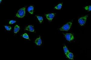 IF analysis of CPS1 using anti-CPS1 antibody (ABIN7599871). (CPS1 Antikörper  (AA 124-379))