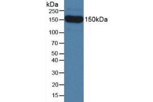 Figure. (SEMA5B Antikörper  (AA 836-1013))