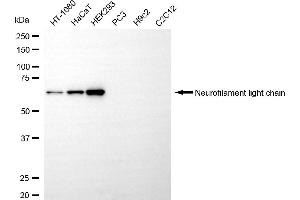 Western blotting analysis using neurofilament light chain antibody (ABIN7799582). (NEFL Antikörper)