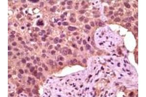 Immunohistochemistry (IHC) image for anti-Glycogen Synthase Kinase 3 alpha (GSK3a) (truncated) antibody (ABIN2464059) (GSK3 alpha Antikörper  (truncated))