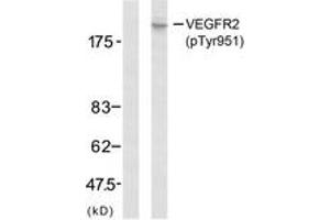 Western blot analysis of extracts from SK-OV3 cells, using VEGFR2 (Phospho-Tyr951) Antibody. (VEGFR2/CD309 Antikörper  (pTyr951))