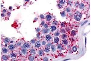 Human Testis (formalin-fixed, paraffin-embedded) stained with WNK1 antibody ABIN213556 at 7 ug/ml followed by biotinylated goat anti-rabbit IgG secondary antibody ABIN481713, alkaline phosphatase-streptavidin and chromogen. (WNK1 Antikörper  (Internal Region))