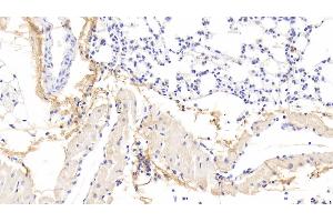 Detection of OGN in Mouse Lung Tissue using Polyclonal Antibody to Osteoglycin (OGN) (OGN Antikörper  (AA 180-298))