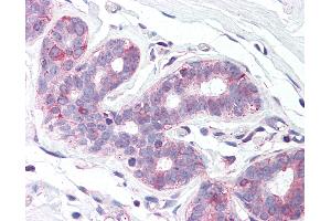 Anti-SLC39A6 antibody IHC of human breast. (SLC39A6 Antikörper  (N-Term))