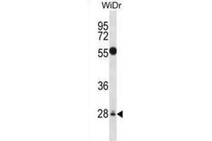 Western Blotting (WB) image for anti-Mediator Complex Subunit 6 (MED6) antibody (ABIN2998132) (MED6 Antikörper)