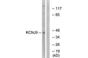 Western blot analysis of extracts from LOVO cells, using KCNJ9 Antibody. (KCNJ9 Antikörper  (AA 61-110))