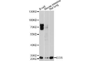 Western blot analysis of extracts of various cell lines, using ICOS antibody (ABIN1873127) at 1:1000 dilution. (ICOS Antikörper)