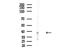 anti-Rhabdoid Tumor Deletion Region Gene 1 (RTDR1) (Internal Region) antibody