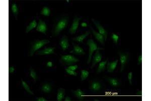 Immunofluorescence of monoclonal antibody to TCF19 on HeLa cell.