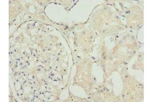 Immunohistochemistry of paraffin-embedded human kidney tissue using ABIN7172851 at dilution of 1:100 (TAGLN2 Antikörper  (AA 1-199))