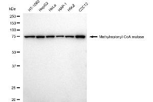Western blotting analysis using Methylmalonyl-CoA mutase antibody (ABIN7799396). (Rekombinanter MUT Antikörper)