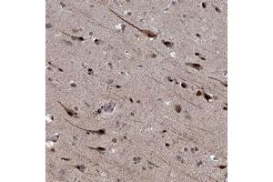 Immunohistochemical staining of human cerebral cortex with PHF8 polyclonal antibody  shows strong nuclear and cytoplasmic positivity in neuronal cells. (PHF8 Antikörper)