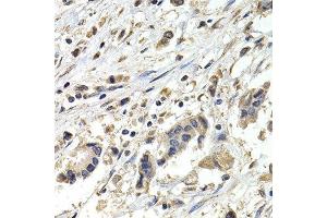 Immunohistochemistry (IHC) image for anti-Budding Uninhibited By Benzimidazoles 1 Homolog beta (Yeast) (BUB1B) (AA 1-260) antibody (ABIN6218879) (BUB1B Antikörper  (AA 1-260))