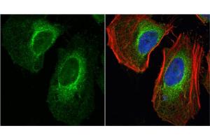 Immunofluorescence (IF) image for anti-Lactate Dehydrogenase A (LDHA) antibody (ABIN2855034)