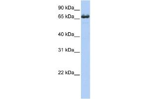 ZDHHC17 Antikörper  (Middle Region)