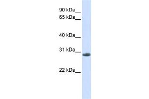 Western Blotting (WB) image for anti-Yip1 Domain Family, Member 6 (YIPF6) antibody (ABIN2458683) (YIPF6 Antikörper)