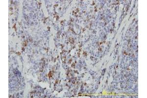Image no. 1 for anti-Ankyrin Repeat and SOCS Box Containing 9 (ASB9) (AA 1-253) antibody (ABIN466270) (ASB9 Antikörper  (AA 1-253))