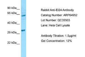 Western Blotting (WB) image for anti-Etoposide Induced 2.4 (EI24) (N-Term) antibody (ABIN970601) (EI24 Antikörper  (N-Term))