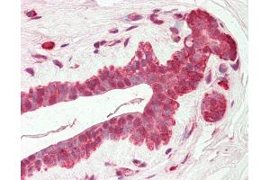 Human Breast: Formalin-Fixed, Paraffin-Embedded (FFPE) (AMIGO2 Antikörper  (C-Term))