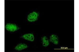 Immunofluorescence of purified MaxPab antibody to SERTAD2 on HeLa cell. (SERTAD2 Antikörper  (AA 1-314))