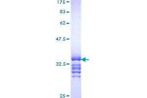 Image no. 1 for Pre-B-Cell Leukemia Homeobox 4 (PBX4) (AA 319-374) protein (GST tag) (ABIN1314116) (PBX4 Protein (AA 319-374) (GST tag))
